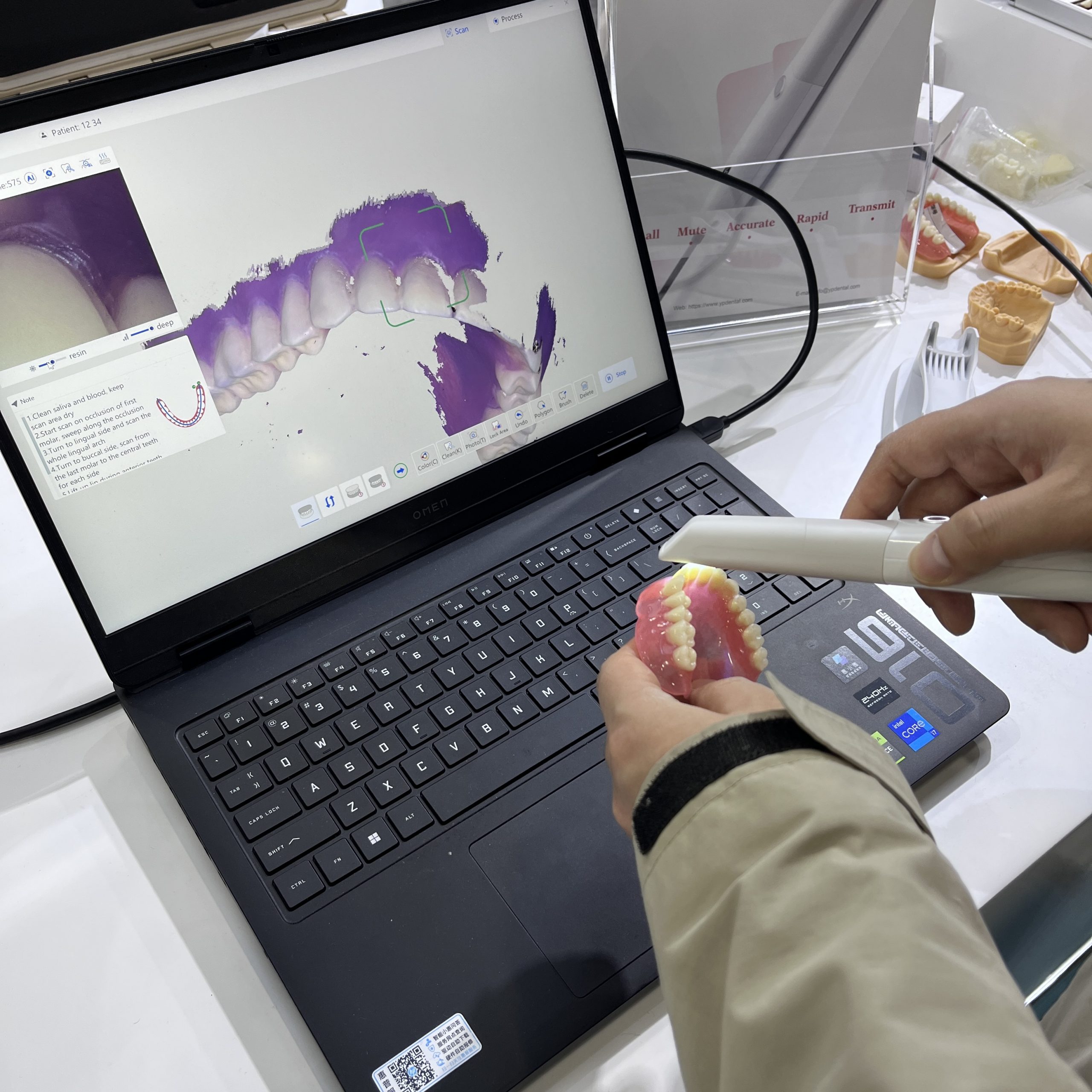 3D Intraoral Scanner